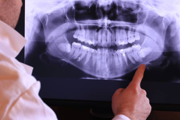 Best Emergency Treatment for Toothache in Port Huron, MI