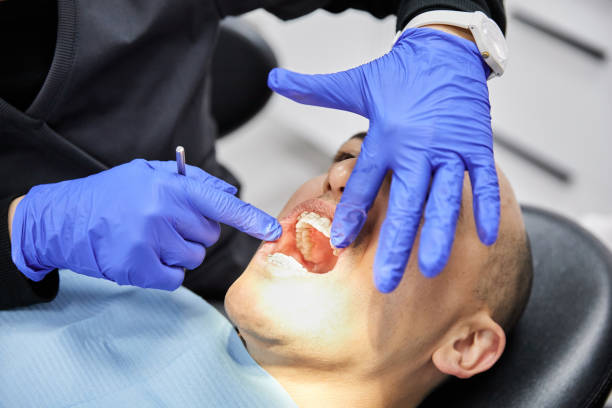 Best Emergency Tooth Extraction in Port Huron, MI